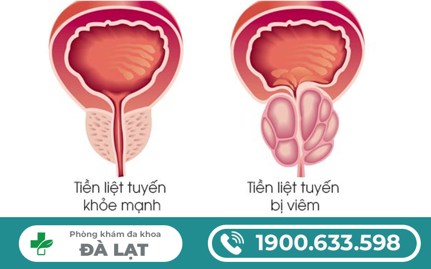 Hình ảnh minh họa